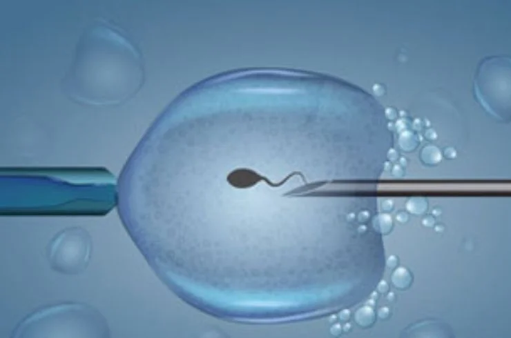 ICSI-IVF-1