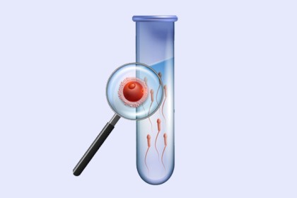 Insemination-and-fertilization